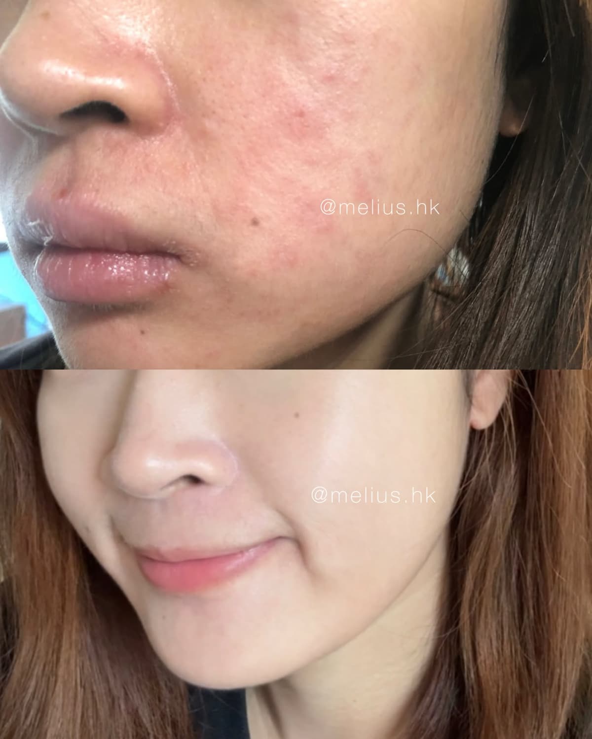 關於 Karla 3